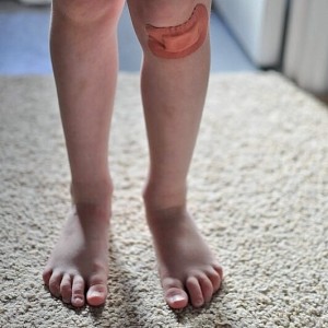 Day 461: My girls are always covered in scrapes, bruises and grazes. This one was particularly nasty after falling over in the playground this morning. She needed lots of cuddles.